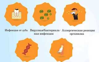 Обзор препаратов, применяемых при лечении гайморита: противовоспалительные, антибактериальные, сосудосуживающие и другие