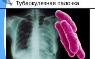 Прививка БЦЖ у новорожденных – состав, подготовка, реакция